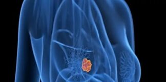 ‘ভেবেই পাচ্ছিলাম না কেন আমার স্তন ক্যান্সার হলো, সবে তিরিশে পা দিয়েছি’