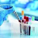 সব সরকারি চাকরি, ড্রাইভিং লাইসেন্স, বিশ্ববিদ্যালয়ে ভর্তিসহ অনেক ক্ষেত্রেই ডোপ টেস্ট বাধ্যতামূলক