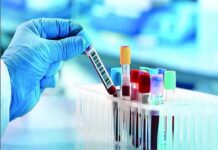 সব সরকারি চাকরি, ড্রাইভিং লাইসেন্স, বিশ্ববিদ্যালয়ে ভর্তিসহ অনেক ক্ষেত্রেই ডোপ টেস্ট বাধ্যতামূলক