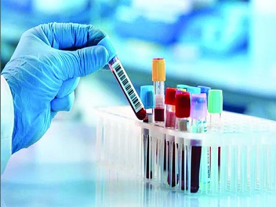 সব সরকারি চাকরি, ড্রাইভিং লাইসেন্স, বিশ্ববিদ্যালয়ে ভর্তিসহ অনেক ক্ষেত্রেই ডোপ টেস্ট বাধ্যতামূলক