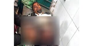 দুর্বৃত্তের হামলায় যুবদলকর্মীর আঙুল বিচ্ছিন্ন