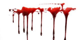 তালাক দেওয়ায় স্ত্রীর নাক কেটে দিলেন স্বামী